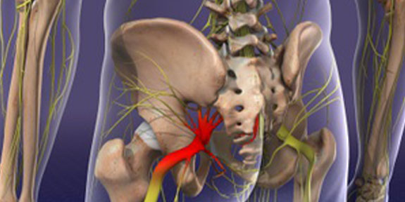 Sciatica Care Brentwood